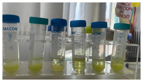 Estrazione del DNA progetto Coltivare il cambiamento Provetto con estrazione del DNA progetto Coltivare il cambiamento