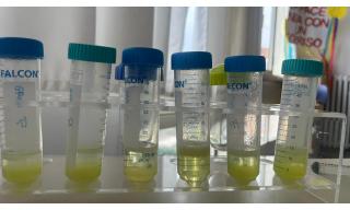 Provetto con estrazione del DNA progetto Coltivare il cambiamento